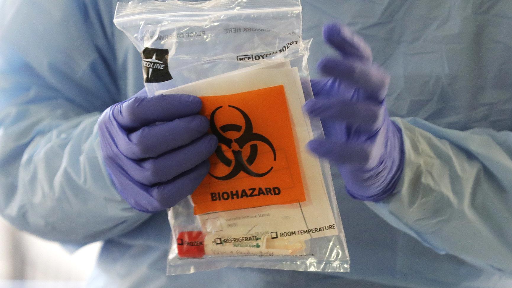 Arizona coronavirus cases top 31,200; 3,479 in Tucson area